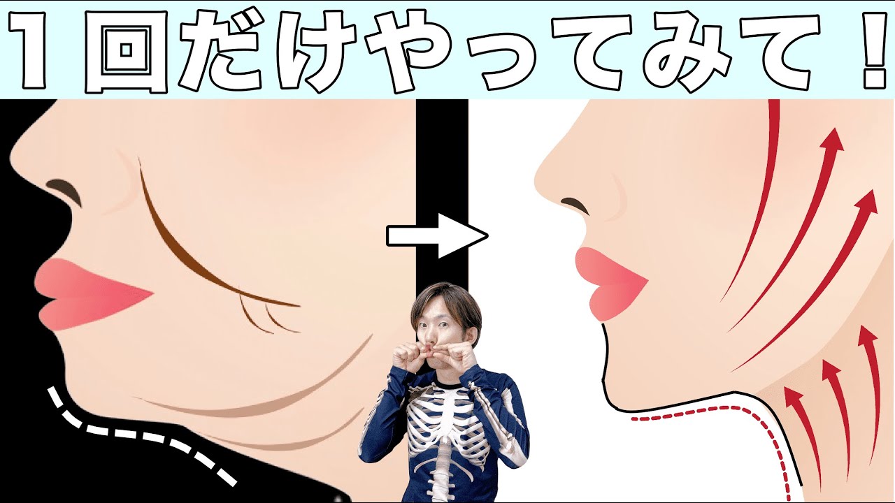 КАК ИЗБАВИТЬСЯ ОТ НАПОЛНИТЕЛЬНЫХ СЛОЖЕНИЙ 8 МИН! | Растяжка буккального жира Laugh Lines