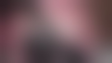 Diabetic Tractional Retinal Detachment - Segmentation