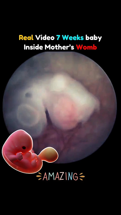 Real Video of 7 Weeks Baby in Mother's Womb 🥰💯 #pregnancy #fetus  #embryo