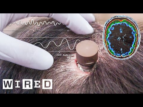 The Science Behind Elon Musks Neuralink Brain Chip | Wired