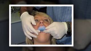 Teeth Whitening Round Lake Beach IL - Tooth Bleaching Round screenshot 5