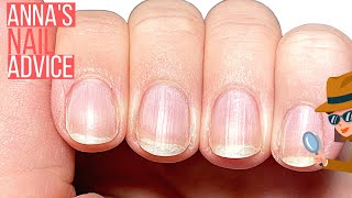 PEELING, BENDY NAILS? WHAT DO I DO?! ANNA, HELP!! [ANNA'S NAIL ADVICE]