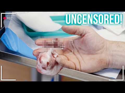 Man Cuts His Fingers Off With Electric Saw | Casualty 24/7 Full Episode Uncensored S05 E18