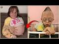 12 Extreme cases that science is still struggling to explain – Born Different