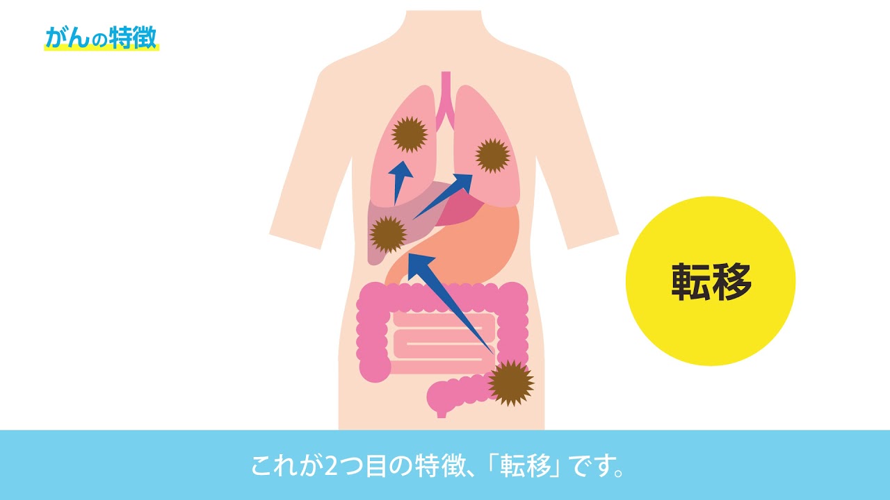 01 がんの現状と発生の仕組み