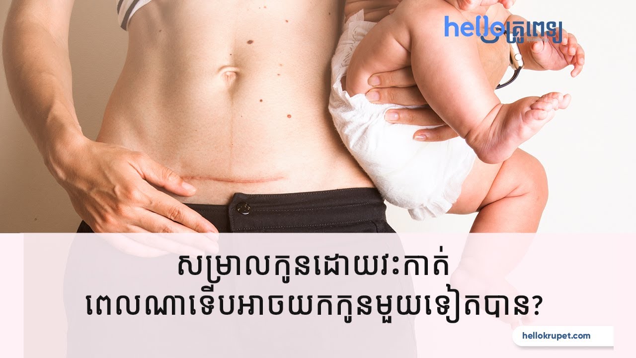 សម្រាលកូនដោយវះកាត់ ពេលណាទើបអាច​​យក​កូន​មួយ​ទៀតបាន?