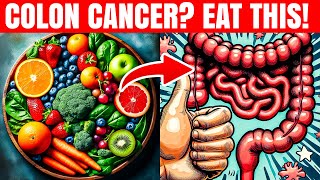 Top 10 Foods to Eliminate Colon Polyps & Stop Bowel Cancer