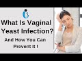 What Is Vaginal Yeast Infection? Women's Sexual Health - Dr Seema Sharma Gynecologist (in Hindi)