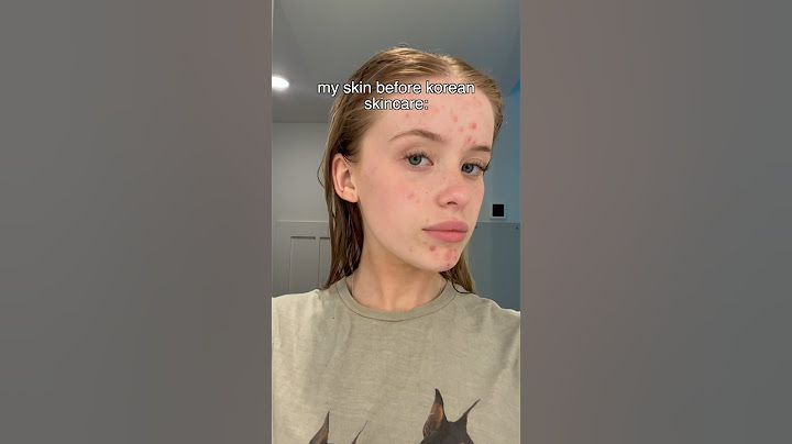 I tried a Korean skincare routine for 3 weeks heres the results so far✨see description 👇🏼😘🫶🏼