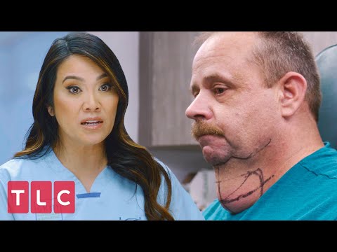 Patient Has a Huge Lump On His Neck | Dr. Pimple Popper