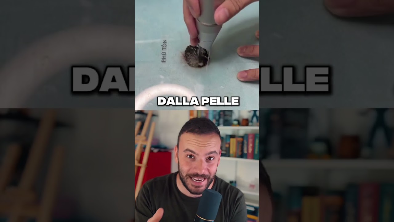 Come funziona la rimozione dei tatuaggi con il laser? 