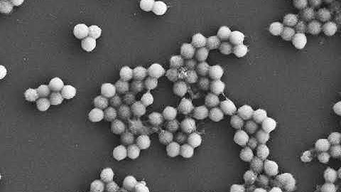 SEM of mimivirus