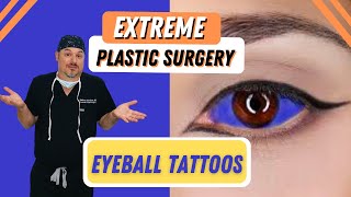Eye Color Change Surgery