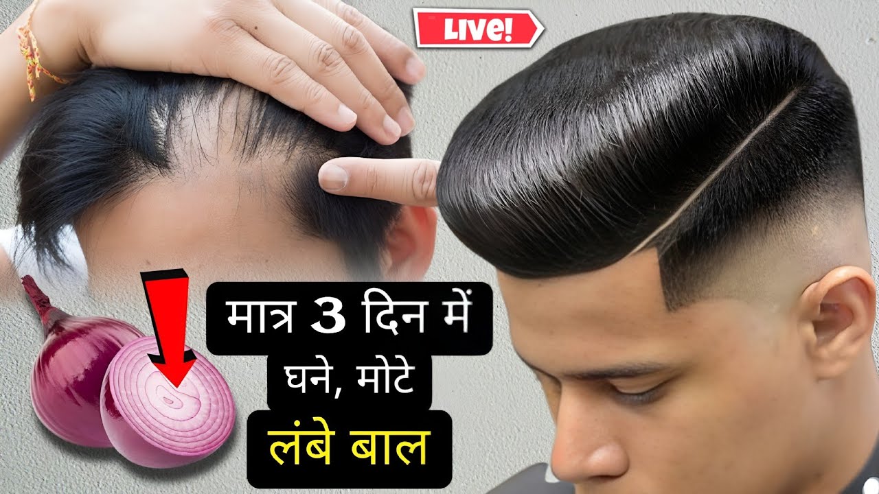 Hair Regrowth Secret | कच्चे प्याज़ का तेल लगाने का सही तरीका | कच्चा प्याज़ Hair Growth Formula