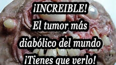 ¿Cuál es el tumor más raro?