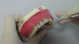[Periodontal Examination Series] 7. Basic Periodontal Examination (BPE)