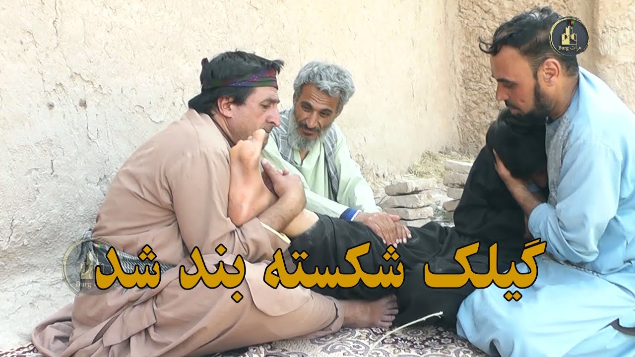 گیلک شکسته بند شد