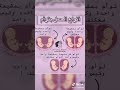 انوا التوائم جوه المشيمه انوا التوائم جوه المشيمه