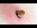 अगर आपको यह दिखे तो तुरंत भाग जाइये | Most Uncommon Bugs In The World In Hindi Pt 2