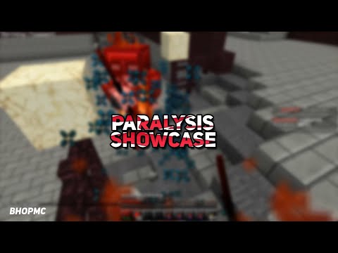 Paralasis Client | ShowCase