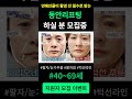 여름한정) 동안리프팅 지원자 모집중 #팔자주름 #눈가주름 #주름 #턱선라인 #이중턱 #40대 #50대 #60대 #연예인 #리프팅 #여름 #관리 #피부 #탄력