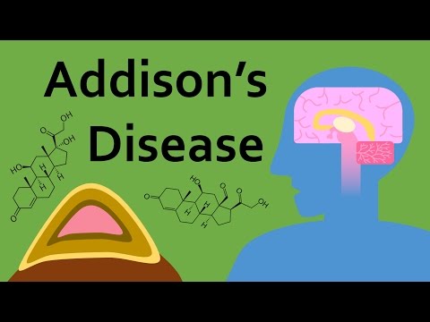 Addison's Disease and Corticosteroids (Part 1)