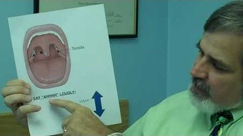 How to Perform a Rapid Strep Test