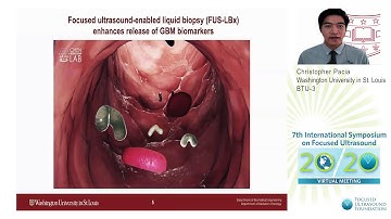 Christopher Pacia - Optimization of FUS-Enhanced Liquid Biopsy for Brain Tumor Diagnosis (2020)