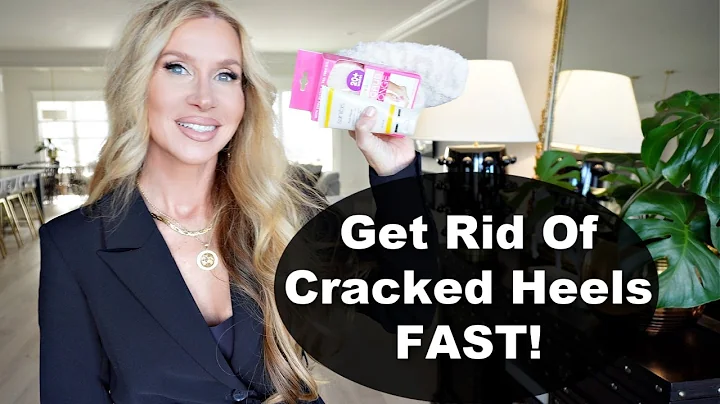 CRACKED HEELS | This Is A Miracle Cream!!