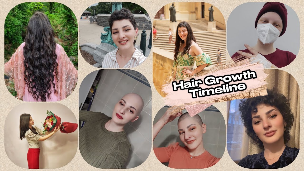 💇 Hair Growth Timeline 🧑‍🦲 💁 Παγκόσμια Ημέρα κατά του Καρκίνου #cancer journey series #15  #hairloss