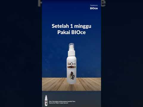 1 Minggu gunakan BIOCE Jerawat Hilang