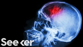 Scientists Are Close to Eliminating Pain, Here’s How Scientists Are Close to Eliminating Pain, Here’s How