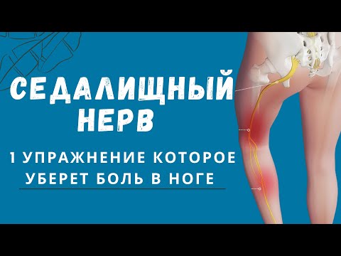 Защемило седалищный нерв? Прострелы закончатся.