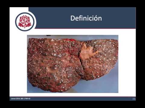 Vídeo: Diferencia Entre Fibrosis Y Cirrosis