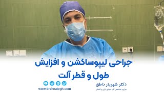 جراحی لیپو ساکشن و افزایش طول و قطر آلت