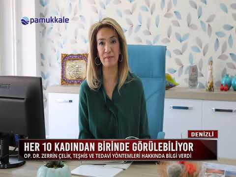 Polikistik Over Sendromu - Op. Dr. Zerrin Çelik