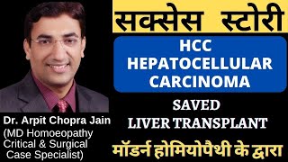 HCC HEPATOCELLULAR CARCINOMA PATIENT SAVED  LIVER TRANSPLANT BY DR ARPIT CHOPRA MODERN HOMOEOPATHY
