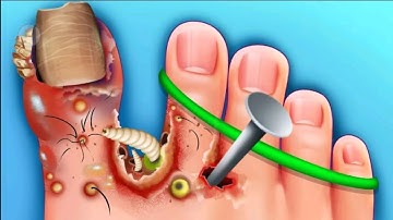 Screwscapes ASMR Level 1-20 Walkthrough Gameplay Android,iOS