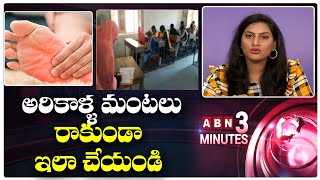 అరికాళ్ళలో మంటలు వస్తున్నాయా? | Treatment For Burning Sensation in Feet | ABN 3 Minutes screenshot 4