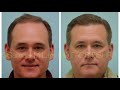 Dallas Hair Transplant Megasession Closeup Results 4 Years Out