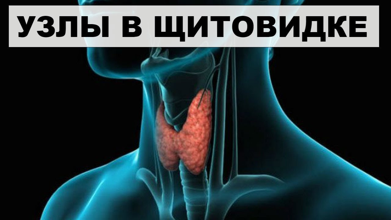 Щитовидной Железы Что Это Такое Фото