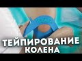 КАК правильно ТЕЙПИРОВАТЬ КОЛЕНО? Травма "колено бегуна"