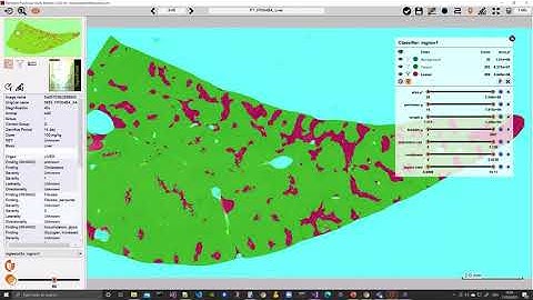 Patholytix AI in Action