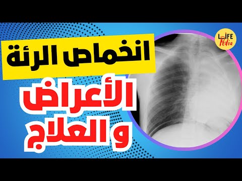 هل تشعر بضيق التنفس قد يكون انخماص الرئة تعرف على الأعراض و الاسباب و طرق العلاج
