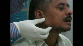 Examination Of Parotid Gland
