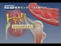 病気の基礎知識 病気の成因・病態の治療　Vol.2 血液の領域