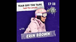 Broken Barbie: Erin’s Journey from Bullying to Amputation and Beyond