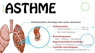 Asthme (état stable) - Cours - Pneumo.Phtisiologie