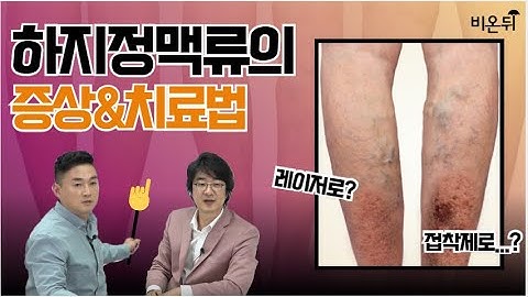 하지정맥류 최신 치료법을 알려드립니다  -김대중 혈관외과전문의-