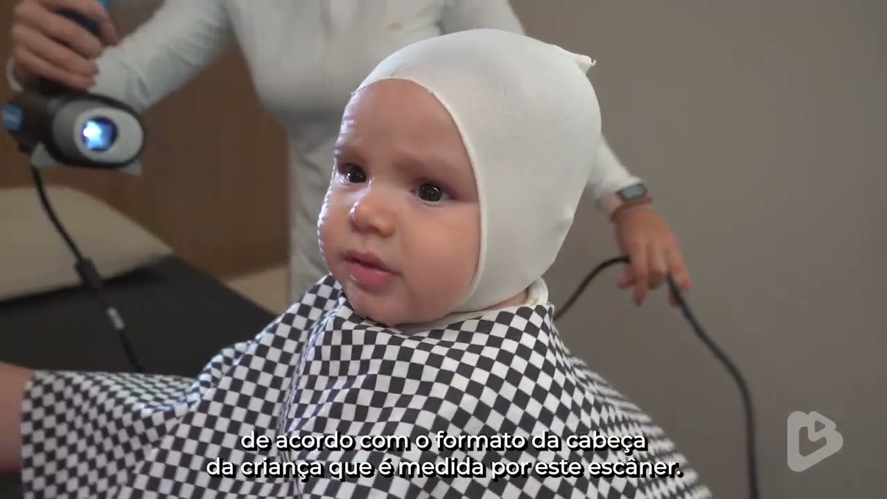 DoctorPlay | A assimetria craniana e o tratamento revolucionário que chegou ao Brasil pela Paraíba